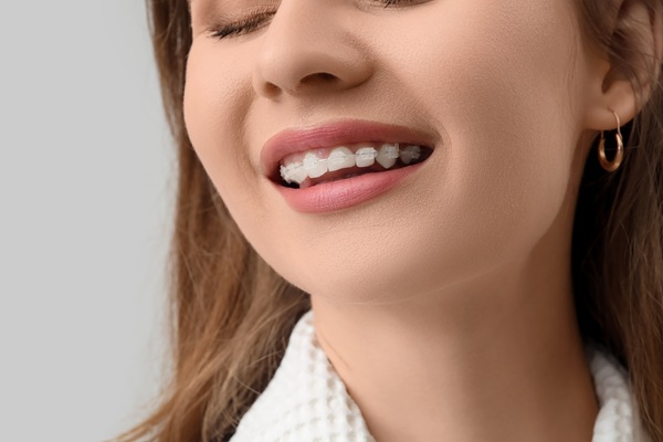 Clear Differences Between Clear Braces And Clear Aligners