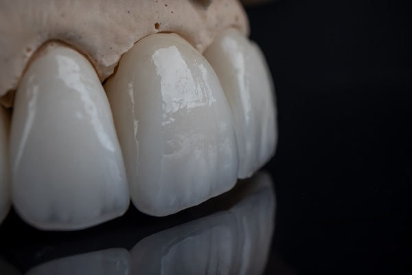 When Is A Dental Crown Recommended?