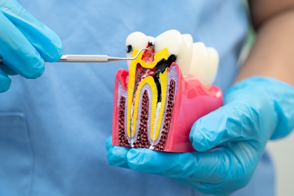Endodontics    : What Really Happens During A Root Canal